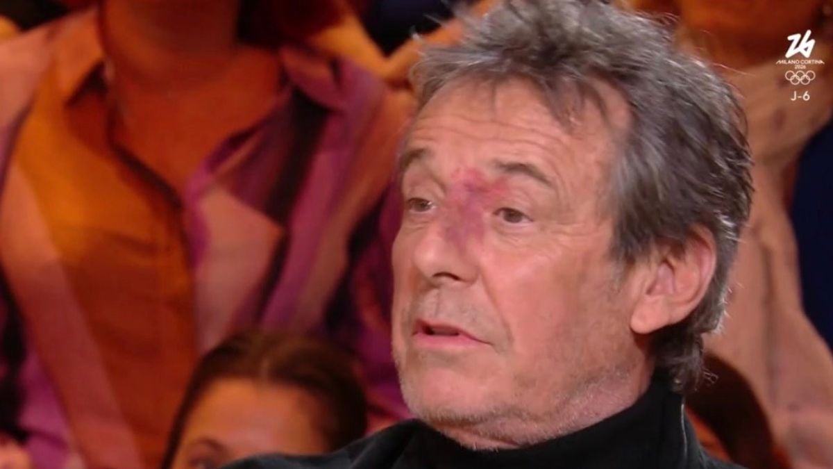 Jean-Luc Reichmann : La tache de vin, un fardeau de l'enfance